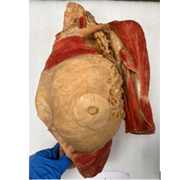 Bluebay®The whole visceral specimen Male with Organ Head, Breast, Eyeball, Heart