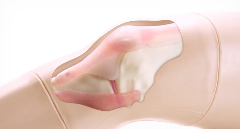 Knee Aspiration & Injection Trainer with Ultrasound Capabilities (Light Skin Tone) (70103)
