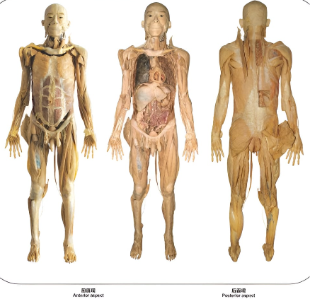 Bluebay®The whole visceral specimen Male with Organ Head, Breast, Eyeball, Heart