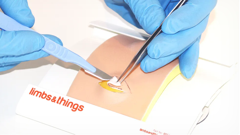 Lipoma Pad (00081)